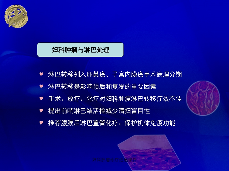 妇科肿瘤诊疗进展课件.ppt_第3页