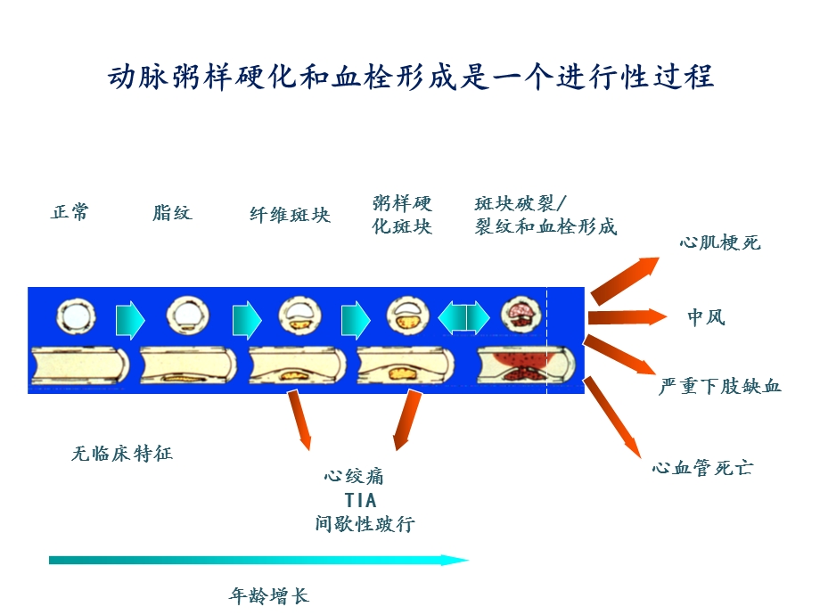 抗血小板凝集药物课件.ppt_第3页