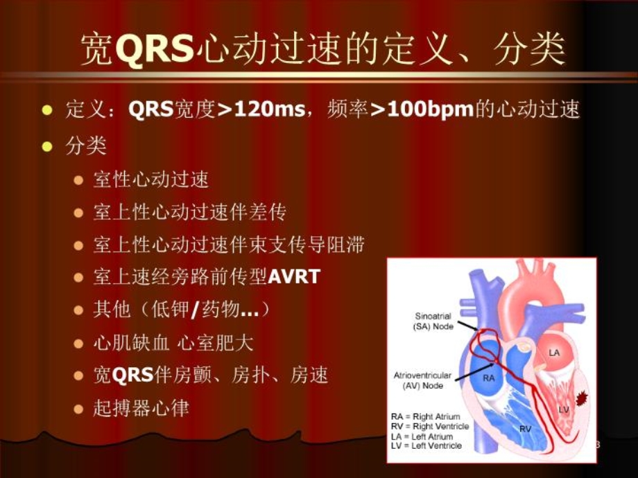 宽QRS心动过速的鉴别诊断课件.ppt_第3页