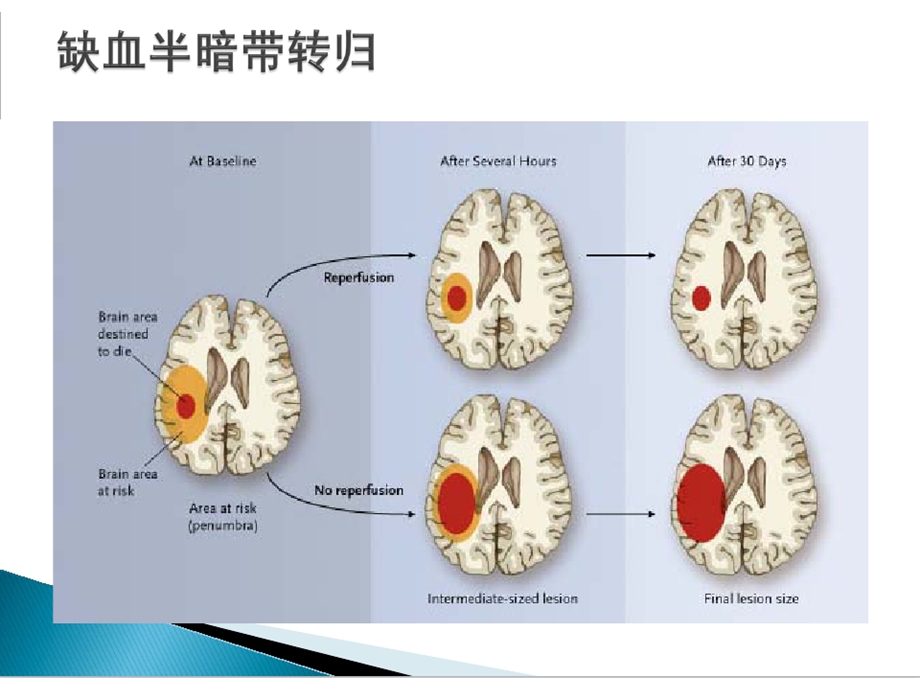 急性脑卒中绿色通道路径课件.ppt_第2页