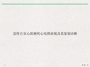 急性右室心肌梗死心电图表现及其鉴别诊断标准课件.ppt