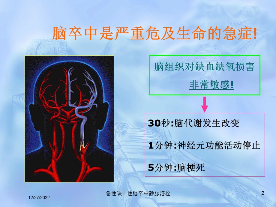 急性缺血性脑卒中静脉溶栓培训课件.ppt_第2页