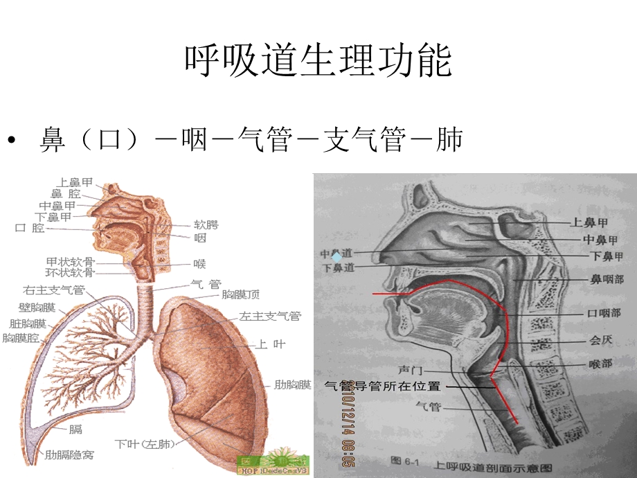 气管切开护理[方案]课件.ppt_第3页