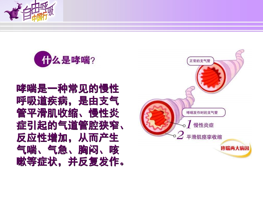 支气管哮喘业务学习ppt课件.ppt_第3页