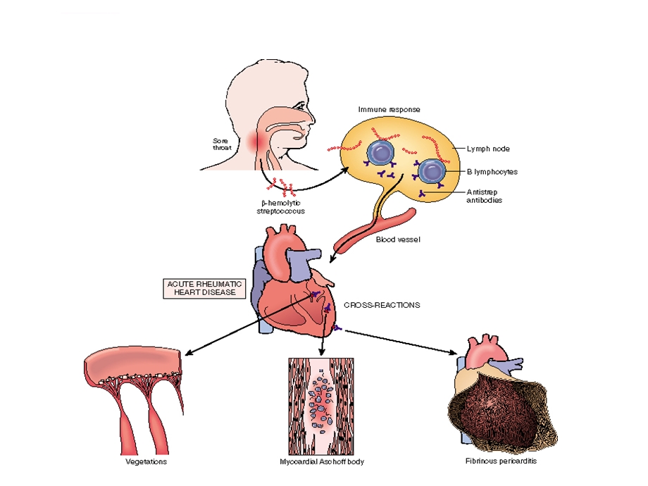 心血管系统疾病ppt课件.ppt_第3页