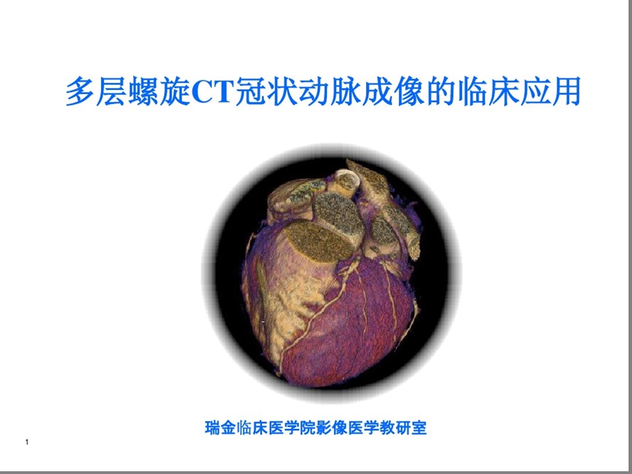 多层螺旋CT冠状动脉成像的临床应用课件.pptx_第1页