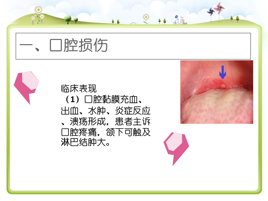 常见护理技术操作并发症预防及处理流程ppt课件.ppt_第3页