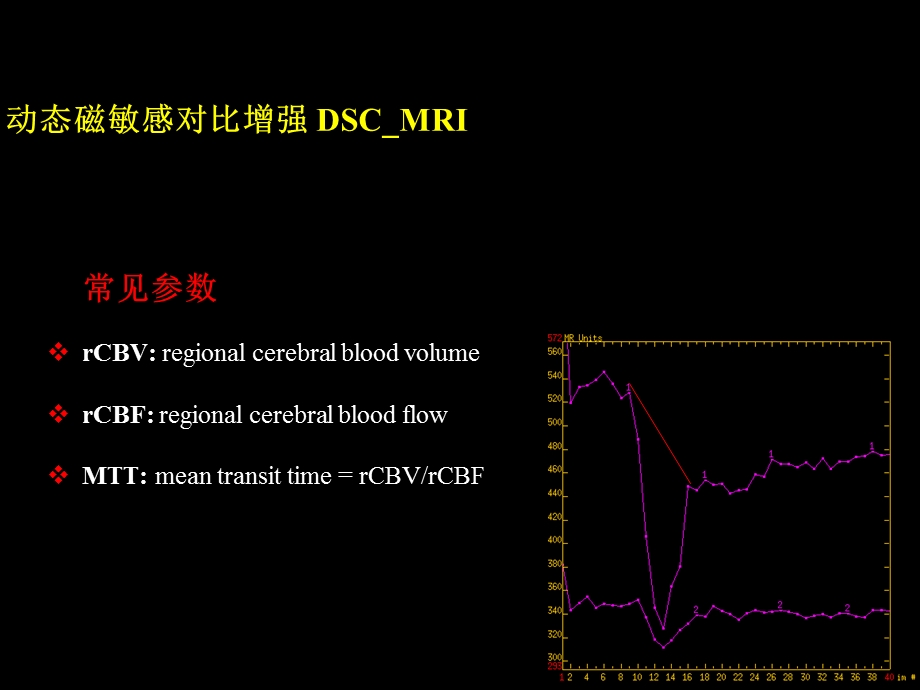 磁共振脑灌注成像介绍ppt课件.ppt_第3页