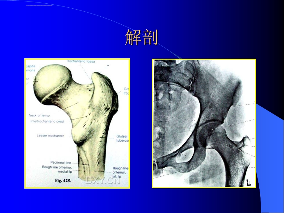 股骨转子间骨折(定稿)ppt课件.ppt_第3页