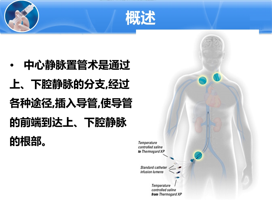 中心静脉置管ppt课件.pptx_第2页