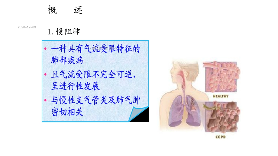 慢阻肺(新课件).ppt_第3页