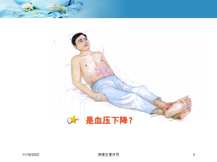 病理生理休克培训课件.ppt_第3页