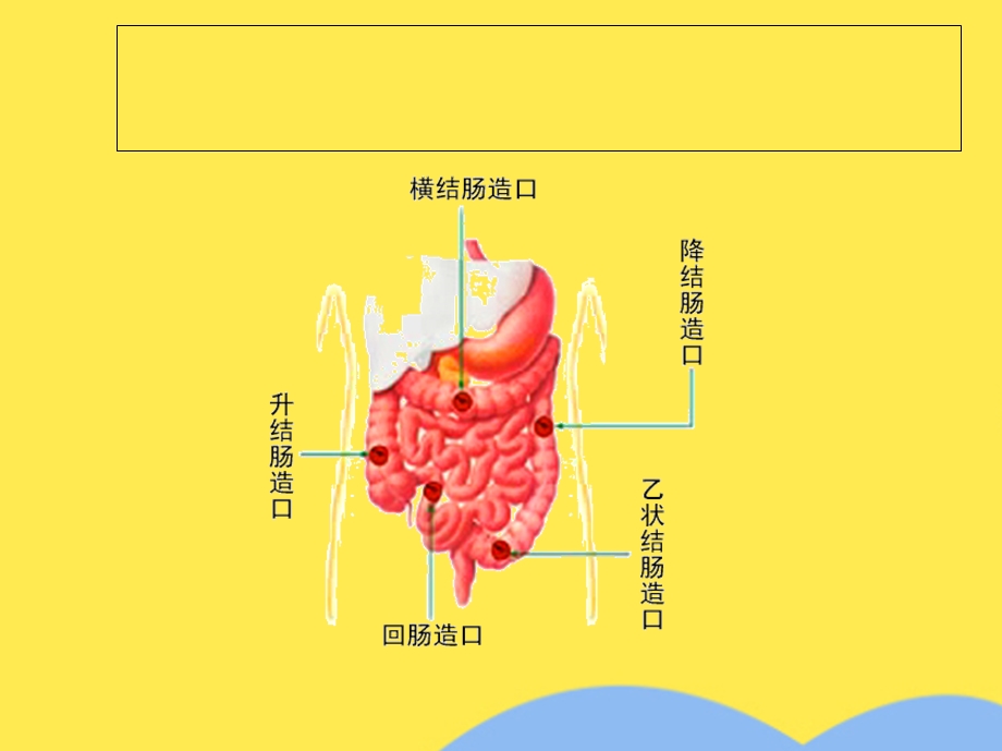 直肠癌围手术期护理课件(共38张).pptx_第3页