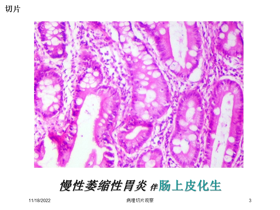 病理切片观察培训课件.ppt_第3页