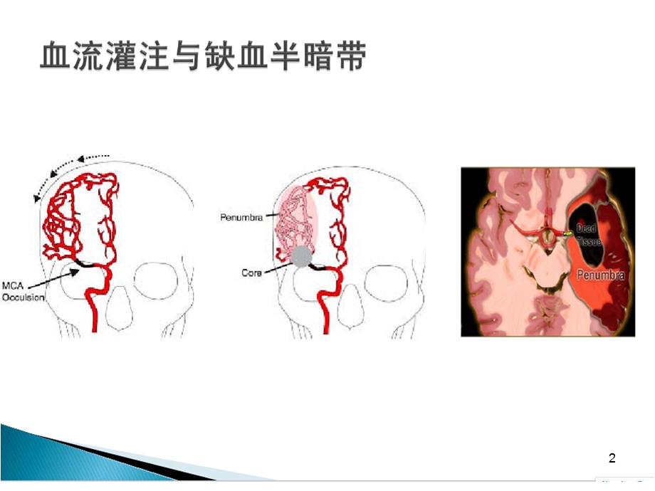 急性脑卒中绿色通道路径学习课件.ppt_第2页