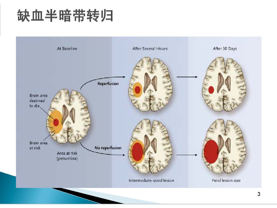 急性脑卒中绿色通道路径学习课件.ppt_第3页