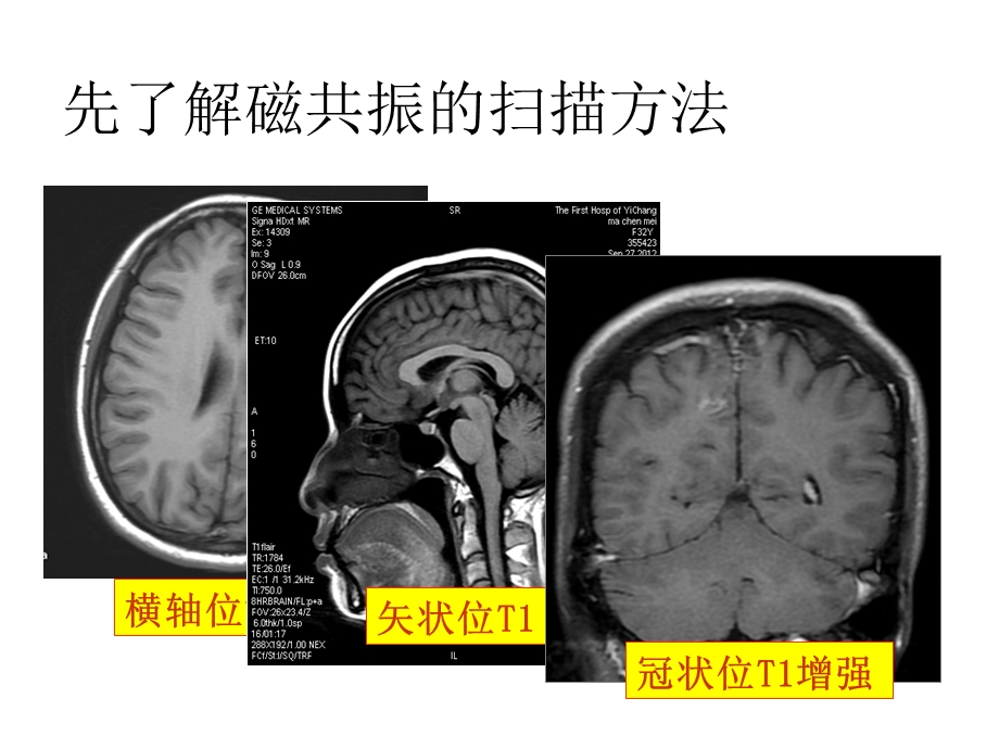 颅脑MRI读片入门完整版课件.pptx_第3页