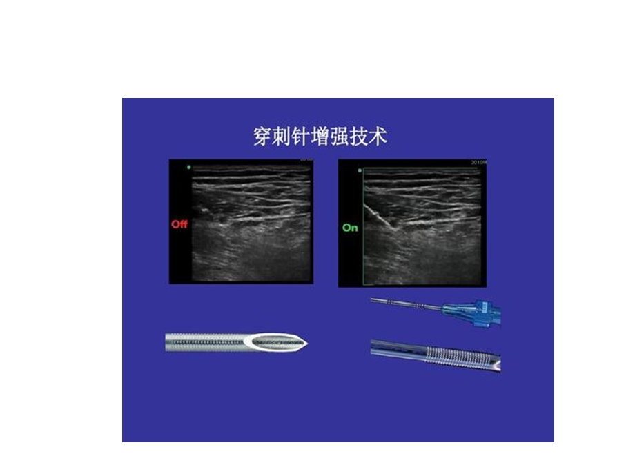 超声穿刺针增强技术课件.pptx_第2页