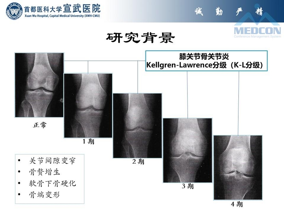 单髁置换术和胫骨高位截骨术治疗膝内侧间室骨性关节炎ppt课件.pptx_第3页