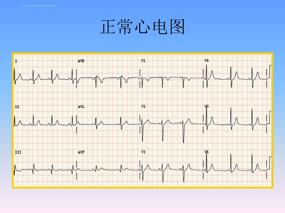 心电图入门教学ppt课件.ppt_第2页