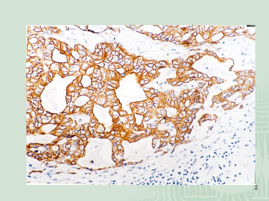 免疫组化结果判断及常见问题的分析课件.ppt_第2页