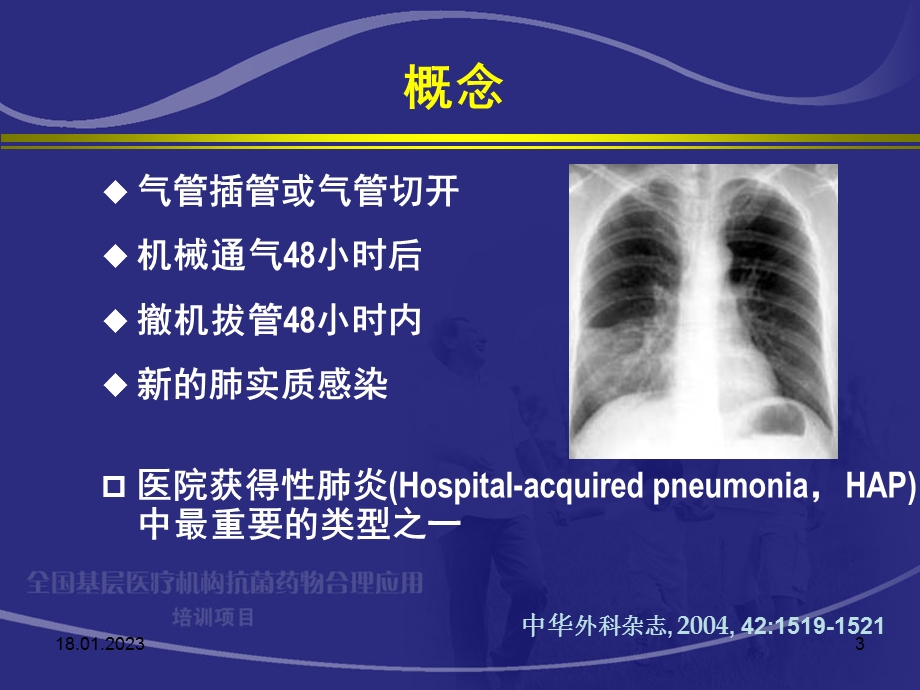 呼吸机相关性肺炎课件.ppt_第3页