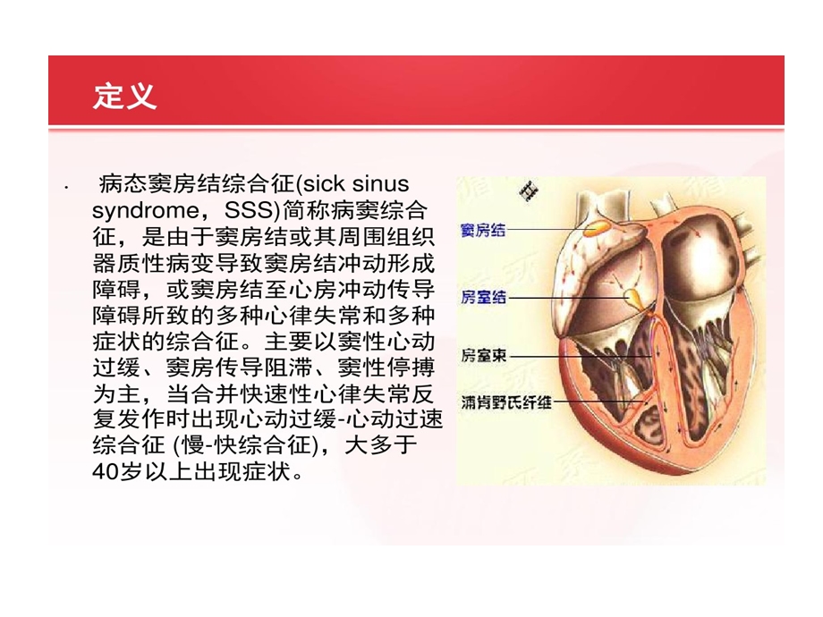 病态窦房结综合症护理查房课件.ppt_第2页