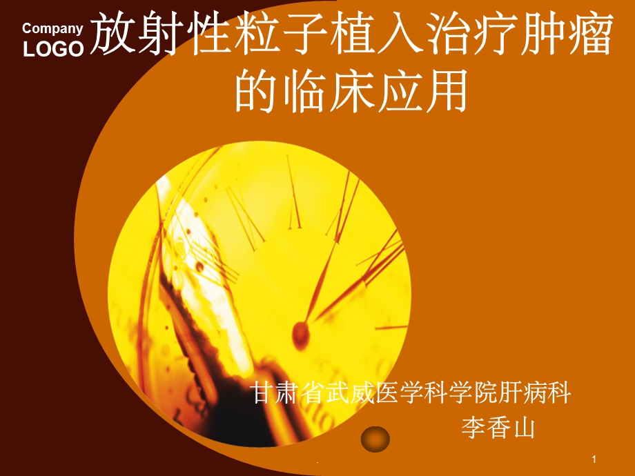 放射性粒子植入治疗肿瘤课件.ppt_第1页