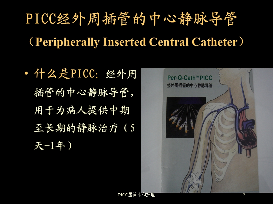 PICC置管术和护理培训课件.ppt_第2页