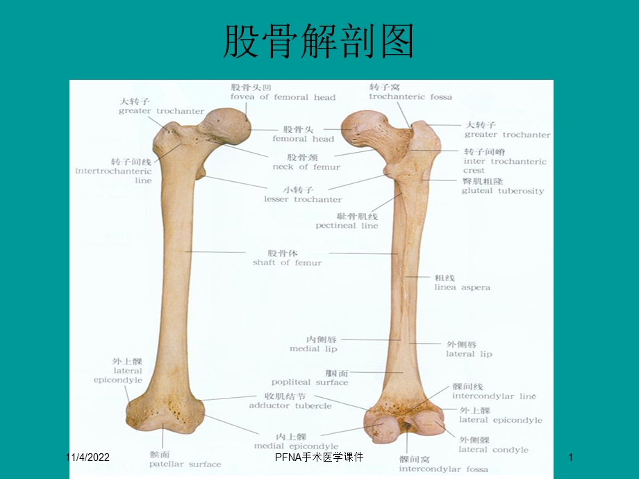 PFNA手术医学课件培训课件.ppt_第1页