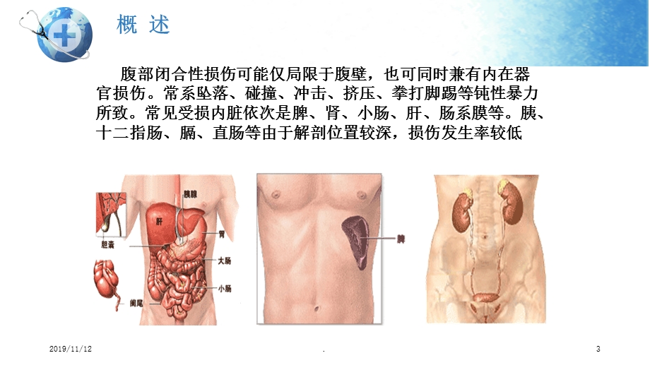闭合性腹部损伤的护理课件.ppt_第3页