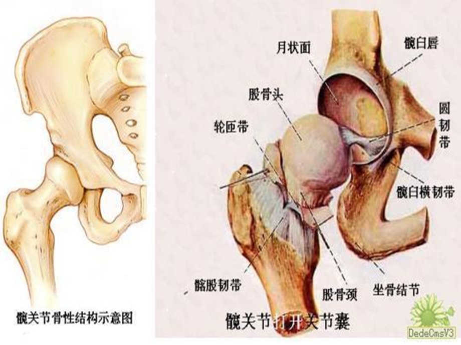 股骨头坏死课件.ppt_第3页