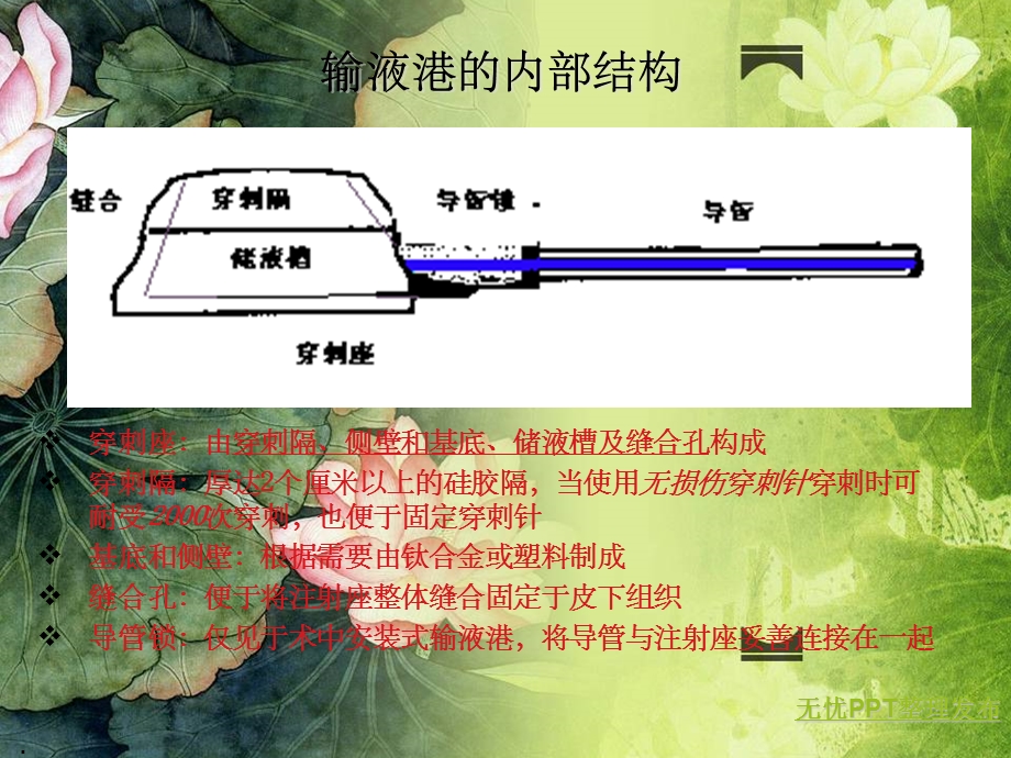 输液港课件.ppt_第3页