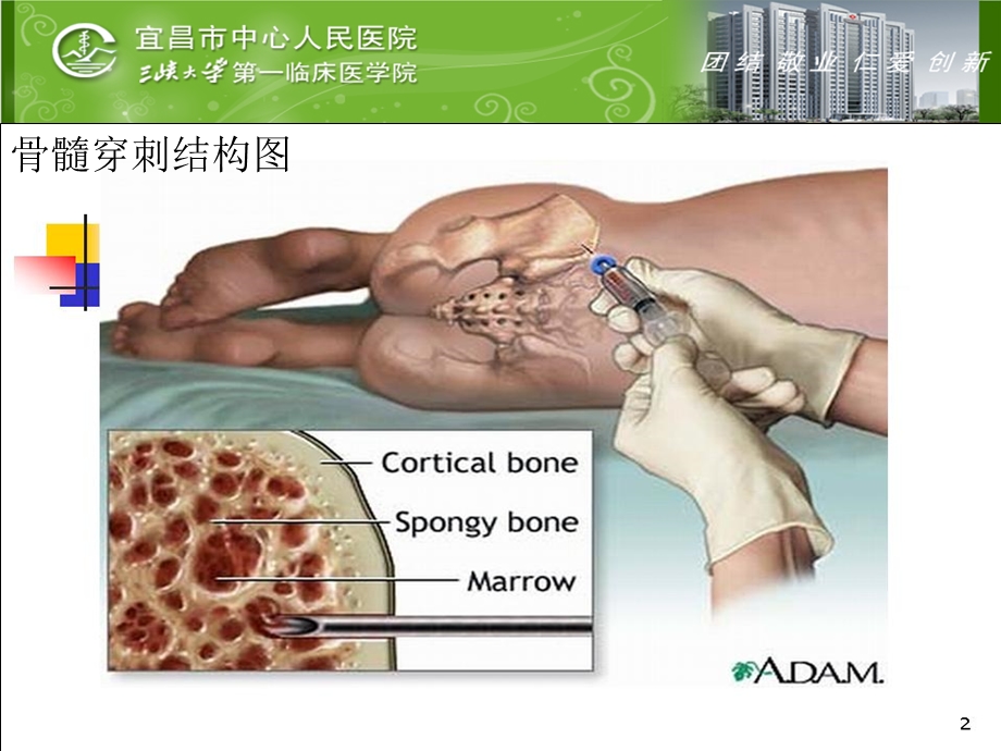 骨髓活检的病理诊断ppt课件.pptx_第3页