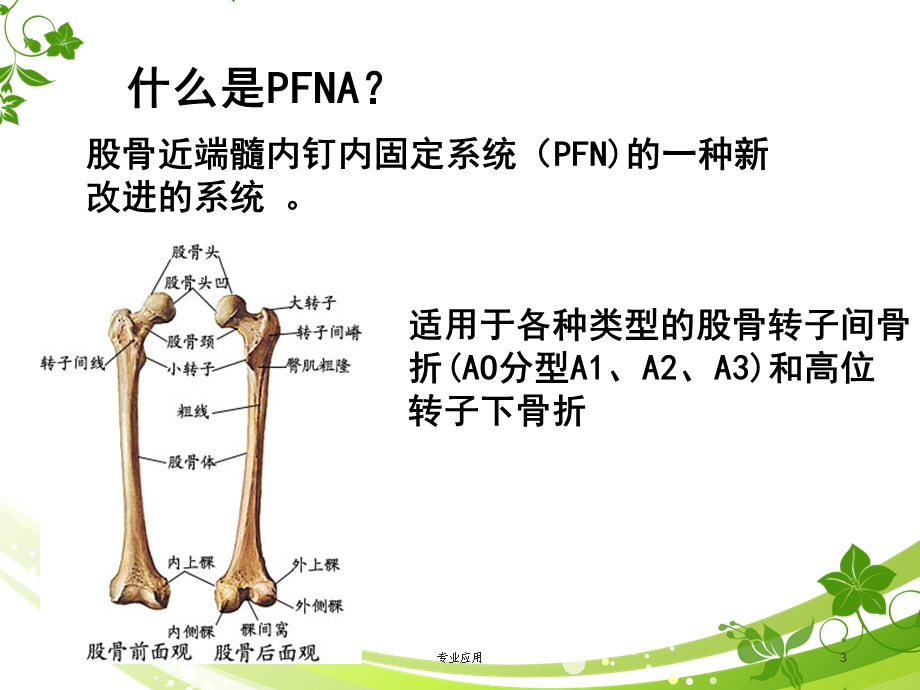 PFNA髓内钉手术配合护理查房课件(研究运.ppt_第3页