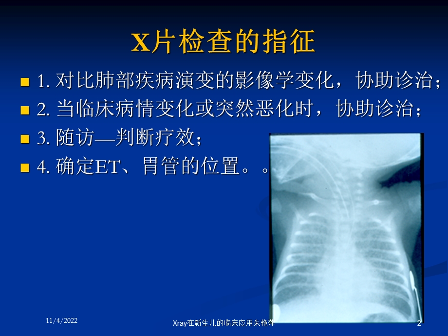 Xray在新生儿的临床应用培训课件.ppt_第2页