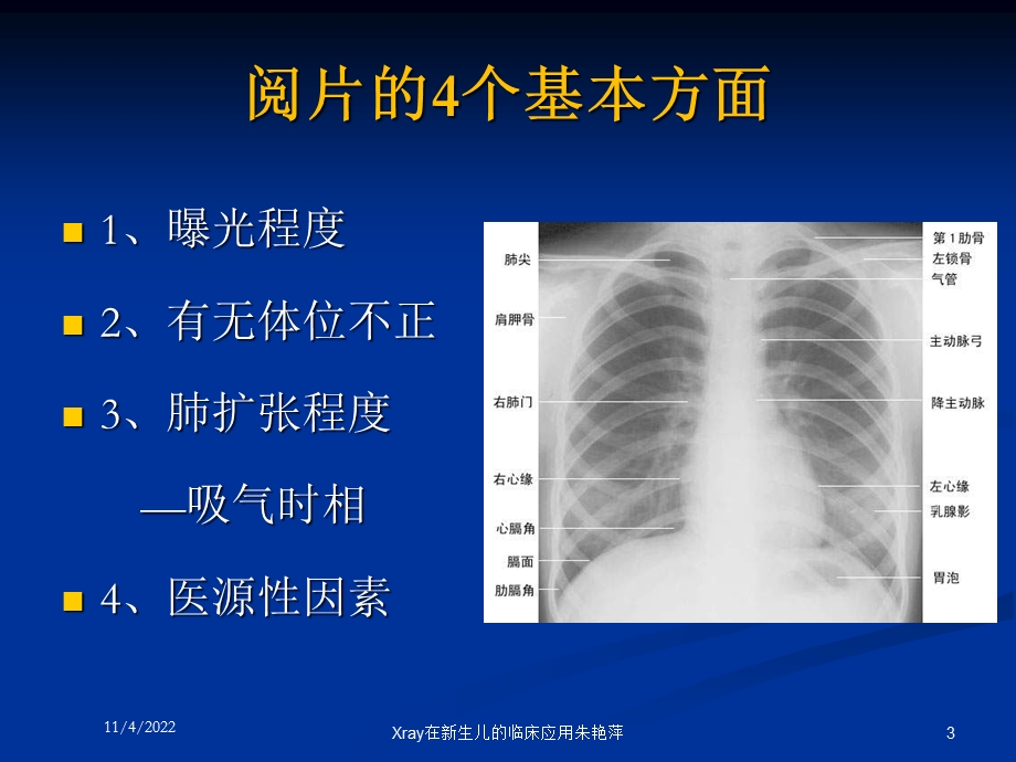 Xray在新生儿的临床应用培训课件.ppt_第3页