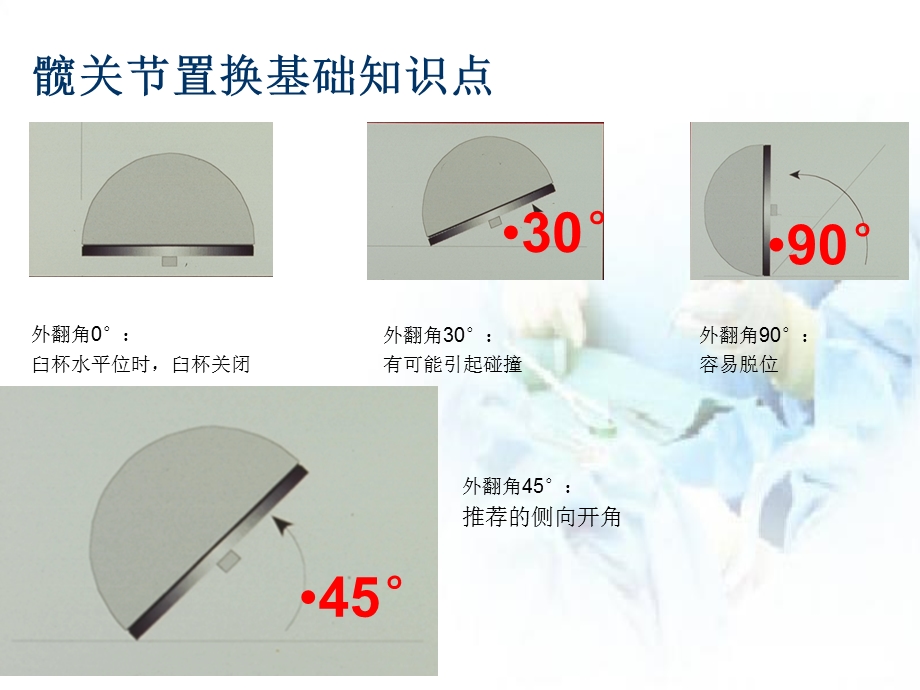 人工髋关节置换基础知识点课件.pptx_第3页