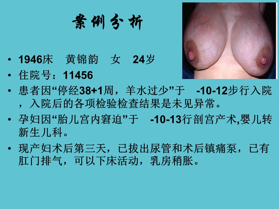 产后乳胀的护理课件.ppt_第2页