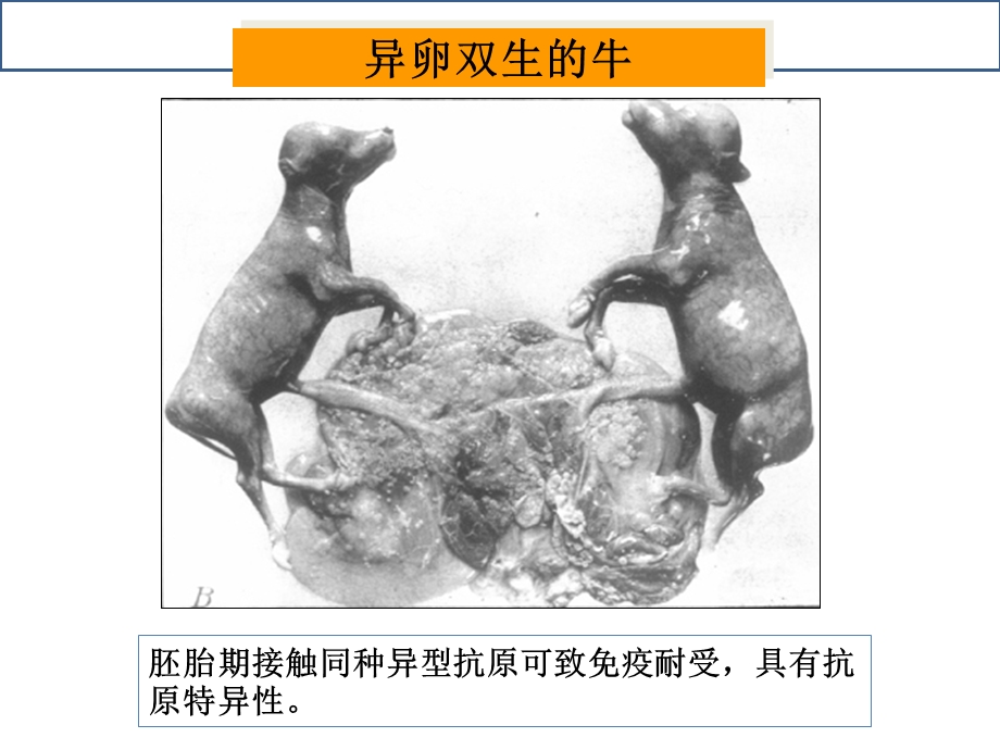 免疫耐受主题医学知识课件.ppt_第3页