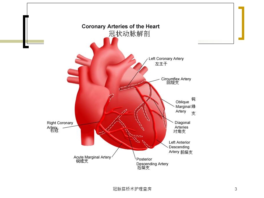 冠脉搭桥术护理查房培训课件.ppt_第3页