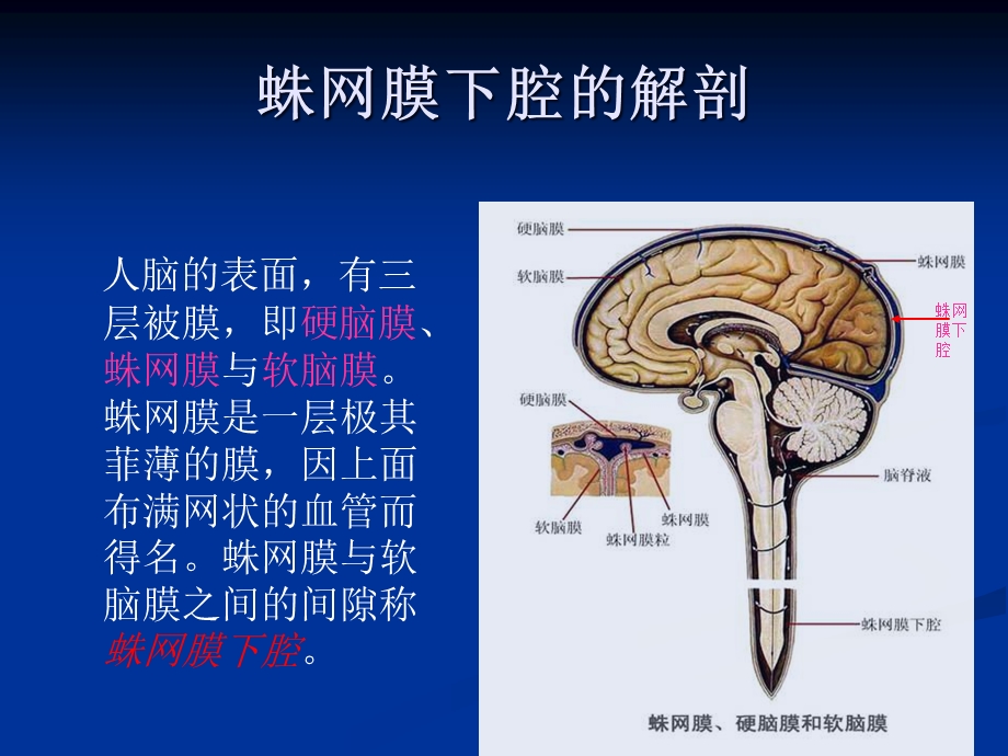 创伤性蛛网膜下腔出血演示教学课件.ppt_第2页