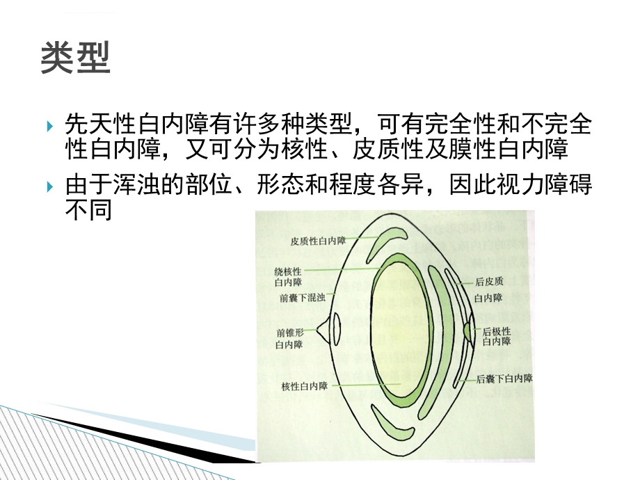 先天性白内障PPT课件.ppt_第3页