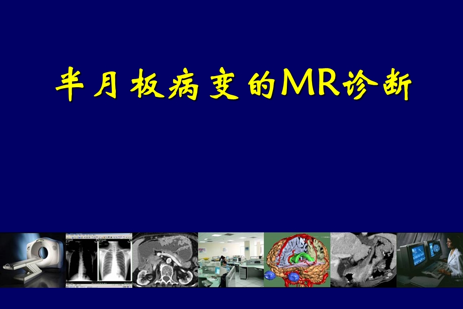 医学影像诊断PPT课件图文详解完整版膝关节半月板病变MR诊断.ppt_第1页