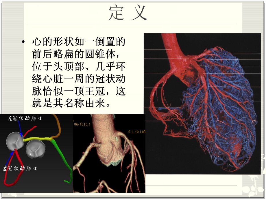 冠脉解剖与CTA(最简单最容易记忆图片最丰富)ppt课件.ppt_第2页