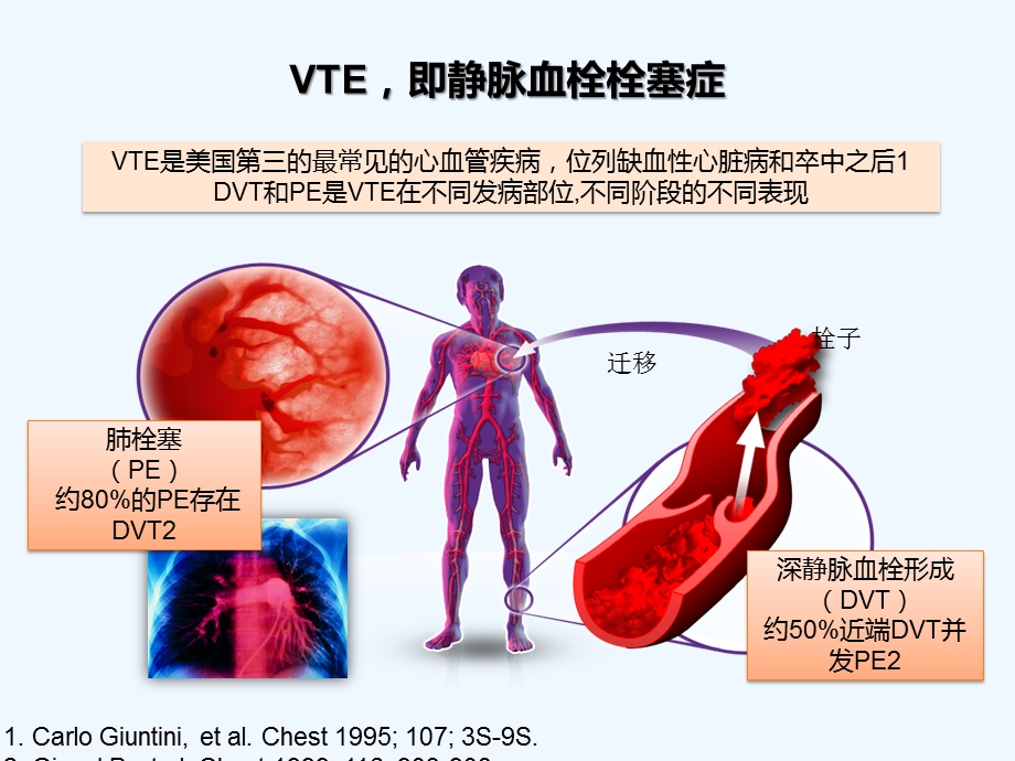 围手术期的VTE预防课件.pptx_第3页