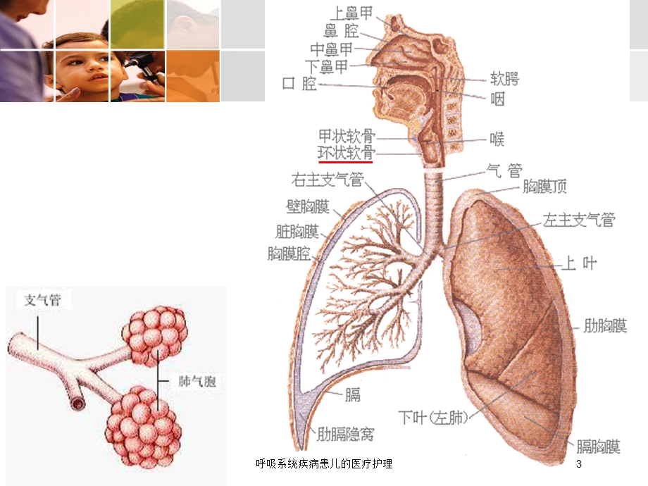 呼吸系统疾病患儿的医疗护理培训课件.ppt_第3页