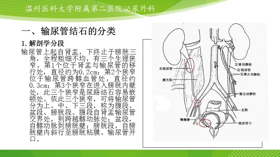 输尿管结石的微创治疗课件.ppt_第2页