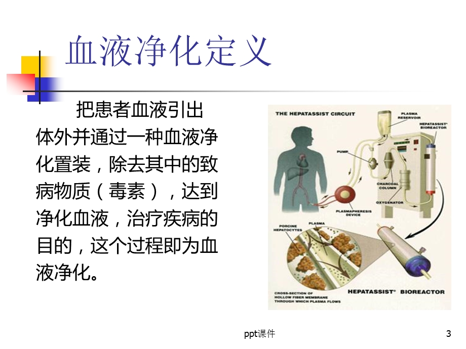 血液净化基本原理及治疗方式的选择课件.ppt_第3页