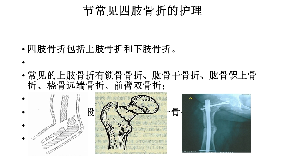 常见四肢骨折护理课件.ppt_第1页